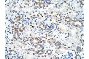 Image no. 1 for anti-LSM2 Homolog, U6 Small Nuclear RNA Associated (LSM2) (C-Term) antibody (ABIN202014) (LSM2 antibody  (C-Term))