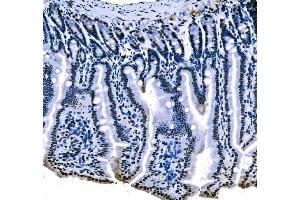 IHC analysis of splicing factor 1 using anti-splicing factor 1 antibody (ABIN7600194). (Splicing Factor 1 antibody  (AA 160-266))