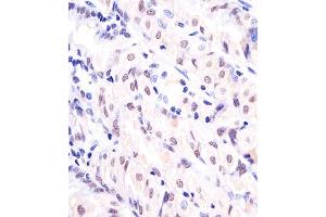 (ABIN6242774 and ABIN6577127) staining EX1 in human stomach sections by Immunohistochemistry (IHC-P - paraformaldehyde-fixed, paraffin-embedded sections). (APEX1 antibody)