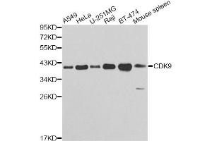 Western blot analysis of extracts of various cell lines, using CDK9 antibody (ABIN5970745) at 1/1000 dilution. (CDK9 antibody)
