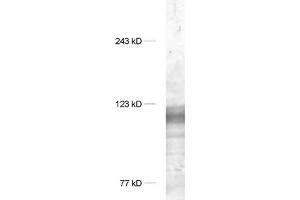 dilution 1 : 1000, sample: synaptic membrane fraction of rat brain (LP1) (DLG1 antibody  (AA 115-133))