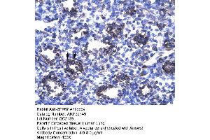 Human Lung (ZBTB7B antibody  (Middle Region))