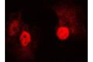 Immunofluorescent analysis of B-RAF staining in A431 cells. (SNRPE antibody  (Center))