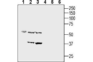 Western blot analysis of Mouse endothelial MS1 cell line lysate (lanes 1 and 4), rat aortic endothelial cell line (RAEC) lysates (lanes 2 and 5) and mouse J774 macrophage cell line lysates (lanes 3 and 6):1-3.