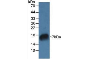 Figure. (RNASE7 antibody  (AA 31-155))