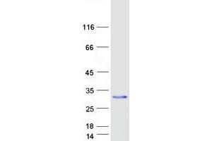 Validation with Western Blot (CD94 Protein (Transcript Variant 1) (Myc-DYKDDDDK Tag))