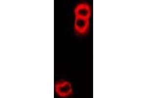 Immunofluorescent analysis of TAP2 staining in U2OS cells. (TAP2 antibody)
