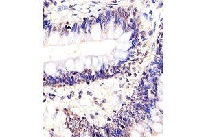 Immunohistochemistry (Paraffin-embedded Sections) (IHC (p)) image for anti-SRY (Sex Determining Region Y)-Box 10 (SOX10) (AA 231-259) antibody (ABIN652035)