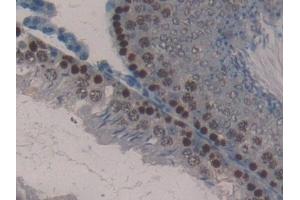 Immunohistochemistry (IHC) image for anti-Kallikrein-Related Peptidase 4 (KLK4) (AA 32-256) antibody (ABIN7431809)