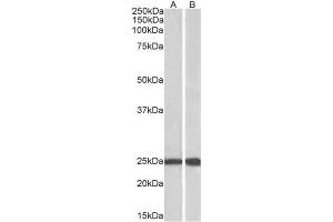 AP23225PU-N RAN antibody staining of Mouse (A) and Rat (B) Testis lysate (35µg protein in RIPA buffer) at 0.