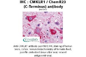 Image no. 1 for anti-Chemokine-Like Receptor 1 (CMKLR1) (C-Term), (Cytoplasmic Domain) antibody (ABIN1733165) (CMKLR1 antibody  (C-Term, Cytoplasmic Domain))