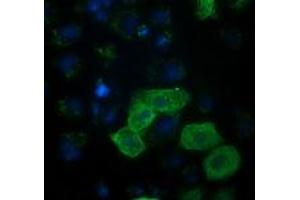 Anti-RASSF1 mouse monoclonal antibody (ABIN2454293) immunofluorescent staining of COS7 cells transiently transfected by pCMV6-ENTRY RASSF1 (RC213525). (RASSF1 antibody)
