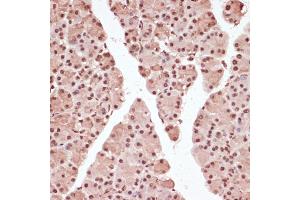 Immunohistochemistry of paraffin-embedded rat pancreas using Phospho--T71 antibody (ABIN3019451, ABIN3019452, ABIN3019453 and ABIN6225376) at dilution of 1:100 (40x lens). (ATF2 antibody  (pThr71))