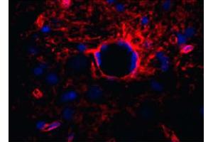 Paraffin embedded rat brain section was stained with anti-AQP4 followed by Goat Anti-Rabbit IgG(H+L), Mouse/Human ads-TXRD (Goat anti-Rabbit IgG (Heavy & Light Chain) Antibody (Texas Red (TR)))