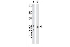 Antibody is used in Western blot to detect KHK in mouse liver tissue lysate (Lane 1) and 293 cell lysate (Lane 2). (Ketohexokinase antibody  (N-Term))