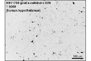 ABIN5539806 (0. (CALB1 antibody  (Internal Region))