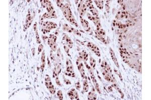 IHC-P Image Immunohistochemical analysis of paraffin-embedded Cal27 Xenograft, using MCM7, antibody at 1:100 dilution. (MCM7 antibody)