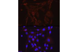 Immunofluorescence (IF) image for anti-Sodium Channel, Nonvoltage-Gated 1 alpha (SCNN1A) (AA 105-225) antibody (ABIN6147447)