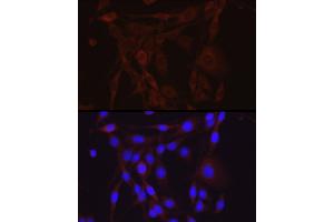 Immunofluorescence analysis of PC-12 cells using SCNN1A Rabbit pAb (ABIN6129465, ABIN6147447, ABIN6147448 and ABIN6221186) at dilution of 1:200 (40x lens). (SCNN1A antibody  (AA 105-225))