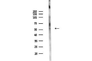 anti-Protein Arginine Methyltransferase 3 (PRMT3) (Internal Region) antibody