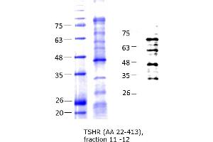 Western Blotting (WB) image for Thyroid Stimulating Hormone Receptor (TSHR) (AA 22-413) protein (His tag) (ABIN3150299) (TSH receptor Protein (AA 22-413) (His tag))