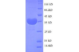 SDS-PAGE (SDS) image for Cystatin B (Stefin B) (CSTB) (AA 1-98), (full length) protein (GST tag) (ABIN7479584) (CSTB Protein (AA 1-98, full length) (GST tag))