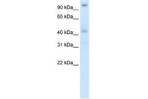 Western Blot showing POGZ antibody used at a concentration of 1-2 ug/ml to detect its target protein. (POGZ antibody  (N-Term))