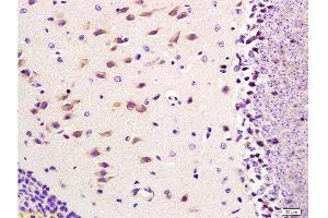 Formalin-fixed and paraffin embedded mouse brain tissue labeled with Anti-CD11b/Integrin αM/Integrin Alpha M Polyclonal Antibody, Unconjugated  at 1:300, followed by conjugation to the secondary antibody and DAB staining (CD11b antibody  (AA 77-180))