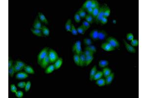 Immunofluorescent analysis of HepG2 cells using ABIN7173663 at dilution of 1:100 and Alexa Fluor 488-congugated AffiniPure Goat Anti-Rabbit IgG(H+L) (TUBA3C antibody  (AA 161-418))