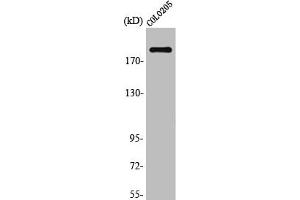 Western Blot analysis of K562 cells using TRAP220 Polyclonal Antibody (MED1 antibody)