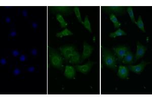 Detection of MCP1 in Human Hela cell using Monoclonal Antibody to Monocyte Chemotactic Protein 1 (MCP1) (CCL2 antibody  (AA 24-125))