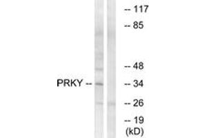 Western blot analysis of extracts from Jurkat cells, using PRKY Antibody. (PRKY antibody  (AA 61-110))