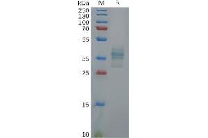 Human GAST Protein, hFc Tag on SDS-PAGE under reducing condition.
