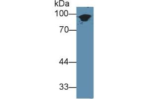 Western Blot; Sample: Mouse Skin lysate; Primary Ab: 3µg/ml Rabbit Anti-Mouse KRT1 Antibody Second Ab: 0. (Cytokeratin 1 antibody  (AA 189-497))