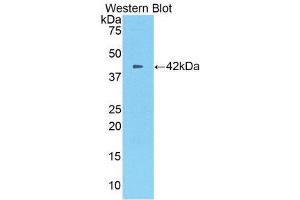 Western Blotting (WB) image for anti-Carboxypeptidase B2 (Plasma) (CPB2) (AA 113-422) antibody (ABIN1860677) (CPB2 antibody  (AA 113-422))