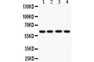 Anti- HEXA antibody,  Western blotting All lanes: Anti HEXA () at 0. (Hexosaminidase A antibody  (Middle Region))