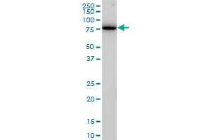 Western Blotting (WB) image for anti-Clathrin Interactor 1 (CLINT1) (AA 161-262) antibody (ABIN599495) (CLINT1 antibody  (AA 161-262))