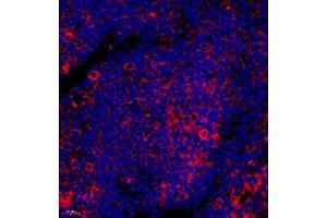 Immunofluorescence of paraffin embedded human tonsil using BTBD6 (ABIN7073235) at dilution of 1:50 (400x lens) (BTBD6 antibody)