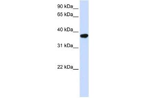 ICMT antibody used at 1 ug/ml to detect target protein. (ICMT antibody  (Middle Region))