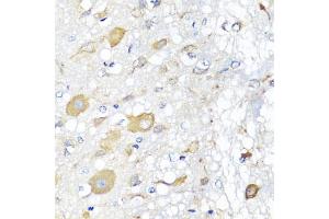 Immunohistochemistry of paraffin-embedded rat brain using CALHM1 antibody (ABIN5975210) at dilution of 1/100 (40x lens). (CALHM1 antibody)