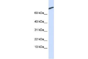 WB Suggested Anti-ARPP-21 Antibody Titration:  0. (ARPP21 antibody  (N-Term))