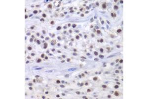 Immunohistochemistry of paraffin-embedded mouse osteosarcoma using HAT1 antibody. (HAT1 antibody  (AA 245-419))