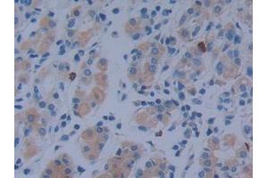 DAB staining on IHC-P; Samples: Human Stomach Tissue (MACC1 antibody  (AA 522-784))