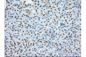 Immunohistochemical staining of paraffin-embedded colon tissue using anti-ERCC1 mouse monoclonal antibody. (ERCC1 antibody)