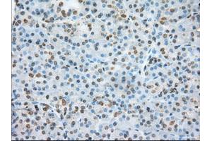 Immunohistochemical staining of paraffin-embedded colon tissue using anti-ERCC1 mouse monoclonal antibody.