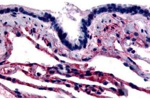 Human Respiratory Epithelium and Alveoli (formalin-fixed, paraffin-embedded) stained with CAV1 antibody ABIN213406 at 4 ug/ml followed by biotinylated goat anti-rabbit IgG secondary antibody ABIN481713, alkaline phosphatase-streptavidin and chromogen. (Caveolin-1 antibody  (N-Term))