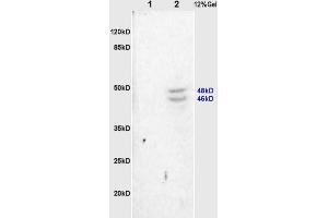 L1 rat heart, L2 rat brain lysates probed (ABIN754888) at 1:200 in 4 °C. (Synaptotagmin antibody  (AA 165-260))