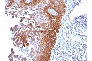 IHC testing of human skin stained with Cytokeratin 17 antibody (E3).