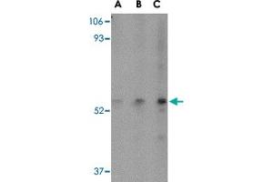 Western blot analysis of SP110 in HeLa cell lysate with SP110 polyclonal antibody  at (A) 0. (SP110 antibody  (C-Term))