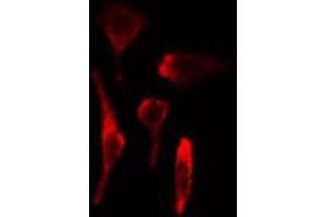 ABIN6269324 staining HeLa cells by IF/ICC. (LIPE antibody  (Internal Region))